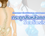 กระดูกสันหลังคด? กายภาพช่วยได้