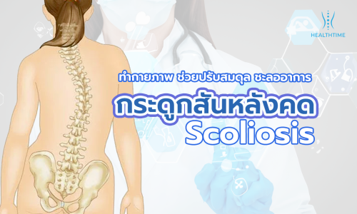 กระดูกสันหลังคด? กายภาพช่วยได้